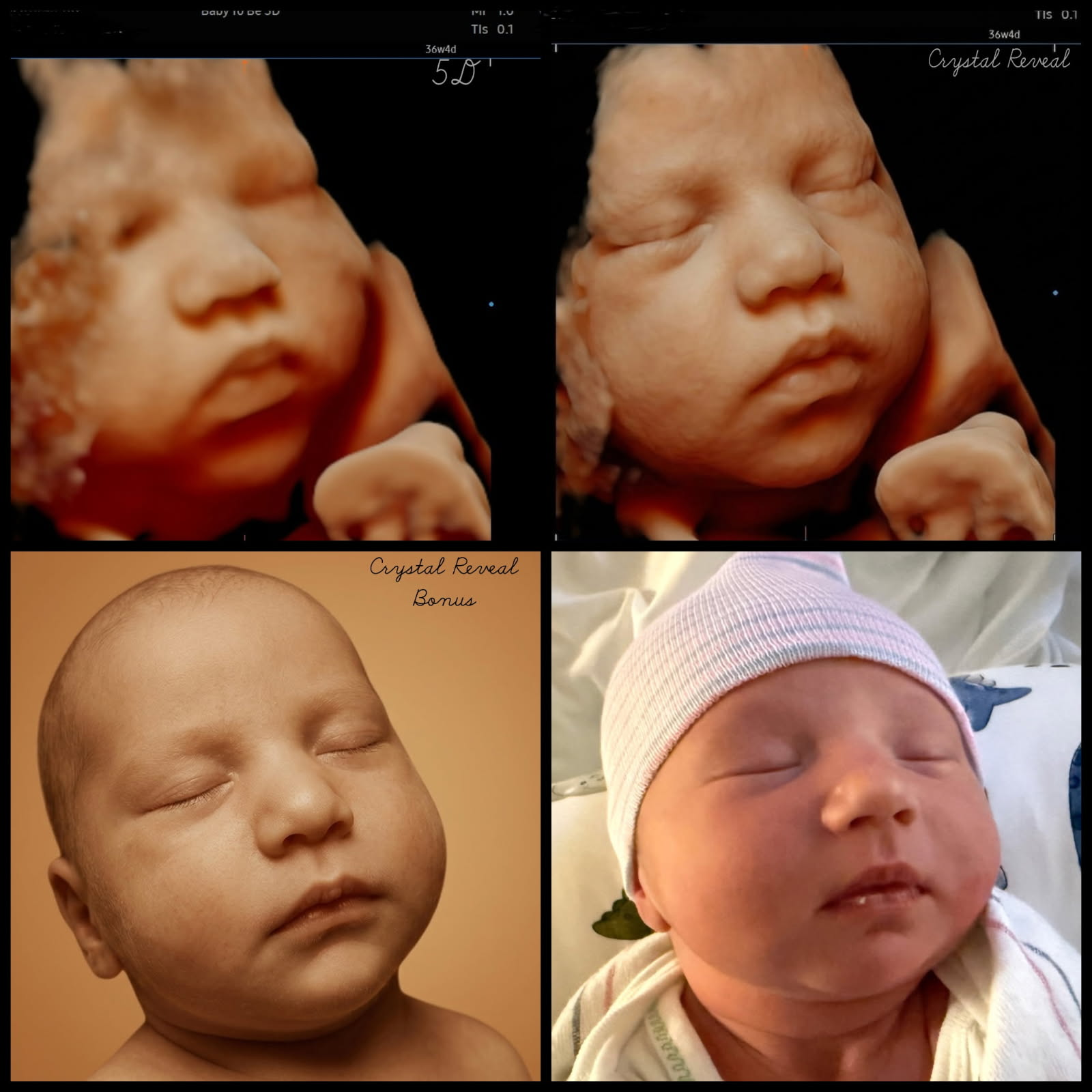 Four-tile comparison: original 5D ultrasound, CrystalReveal Basic, CrystalReveal Bonus, and the real newborn photo after delivery.